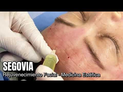 Los 10 Mejores Centros de Estética en Segovia: Belleza y Bienestar a Tu Alcance