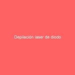 Depilación laser de diodo